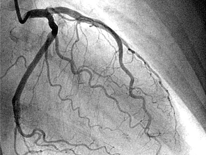 AI Diagnosis Project